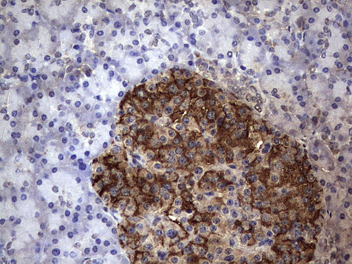 FAF1 Antibody in Immunohistochemistry (Paraffin) (IHC (P))