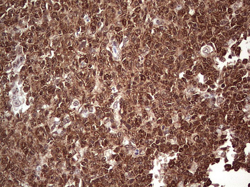 FAF1 Antibody in Immunohistochemistry (Paraffin) (IHC (P))