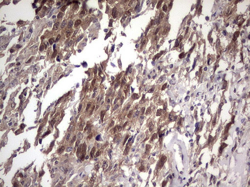 FAF1 Antibody in Immunohistochemistry (Paraffin) (IHC (P))