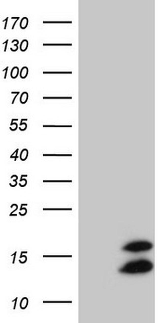 FAM104B Antibody in Western Blot (WB)