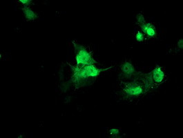 FAM119A Antibody in Immunocytochemistry (ICC/IF)