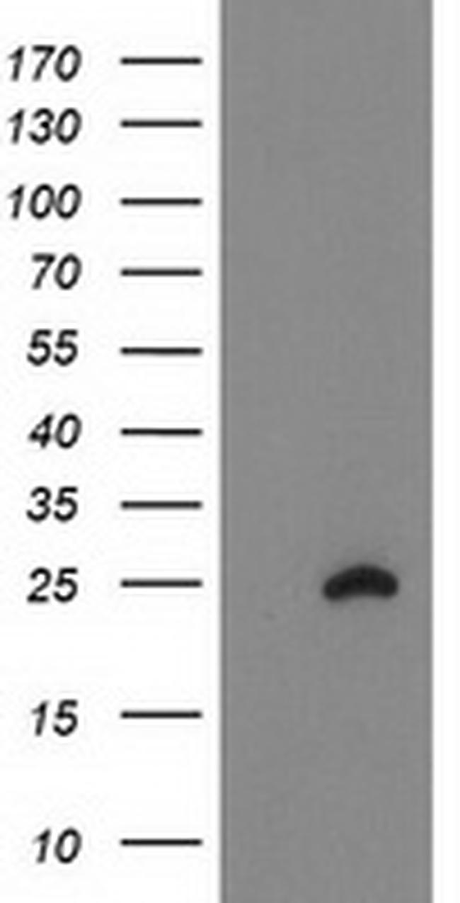 FAM119A Antibody in Western Blot (WB)