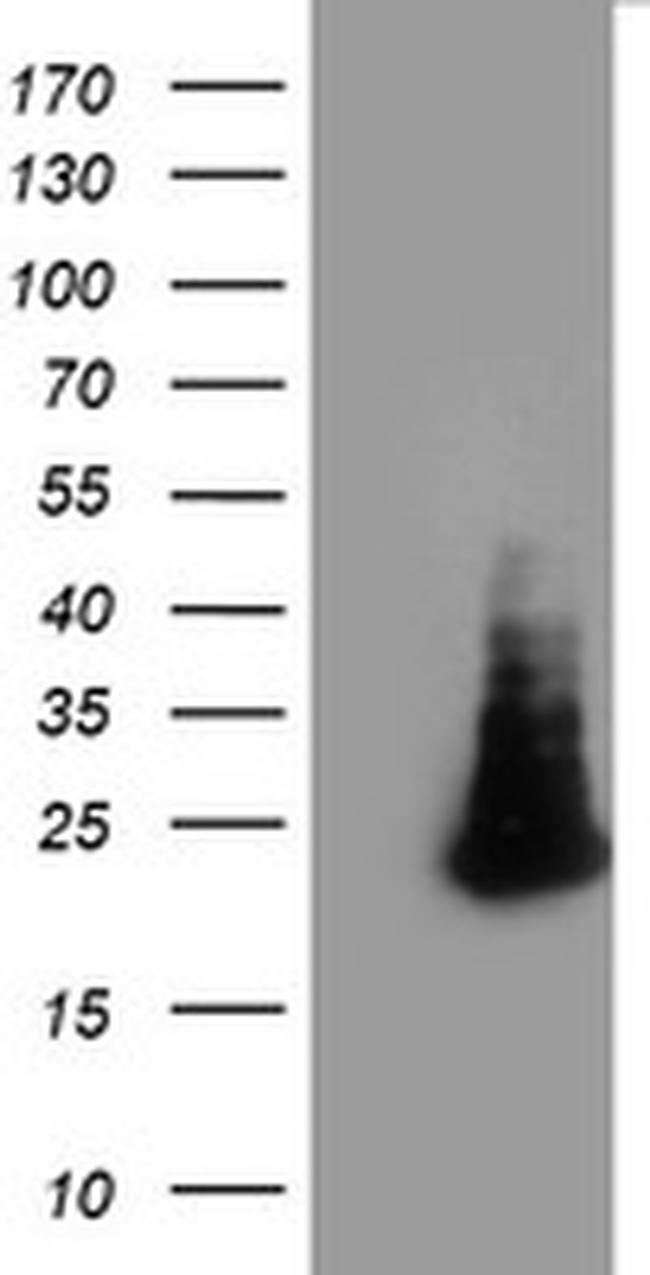 FAM119A Antibody in Western Blot (WB)