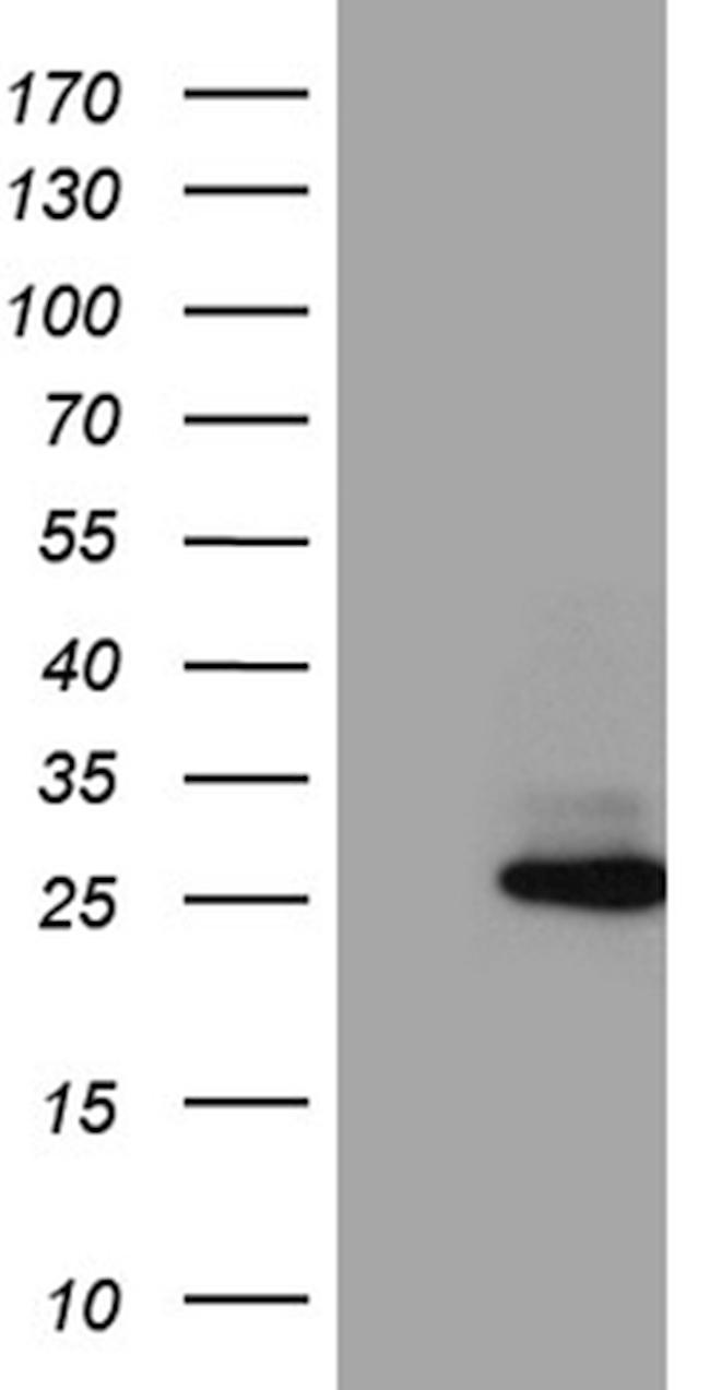 FAM119A Antibody in Western Blot (WB)
