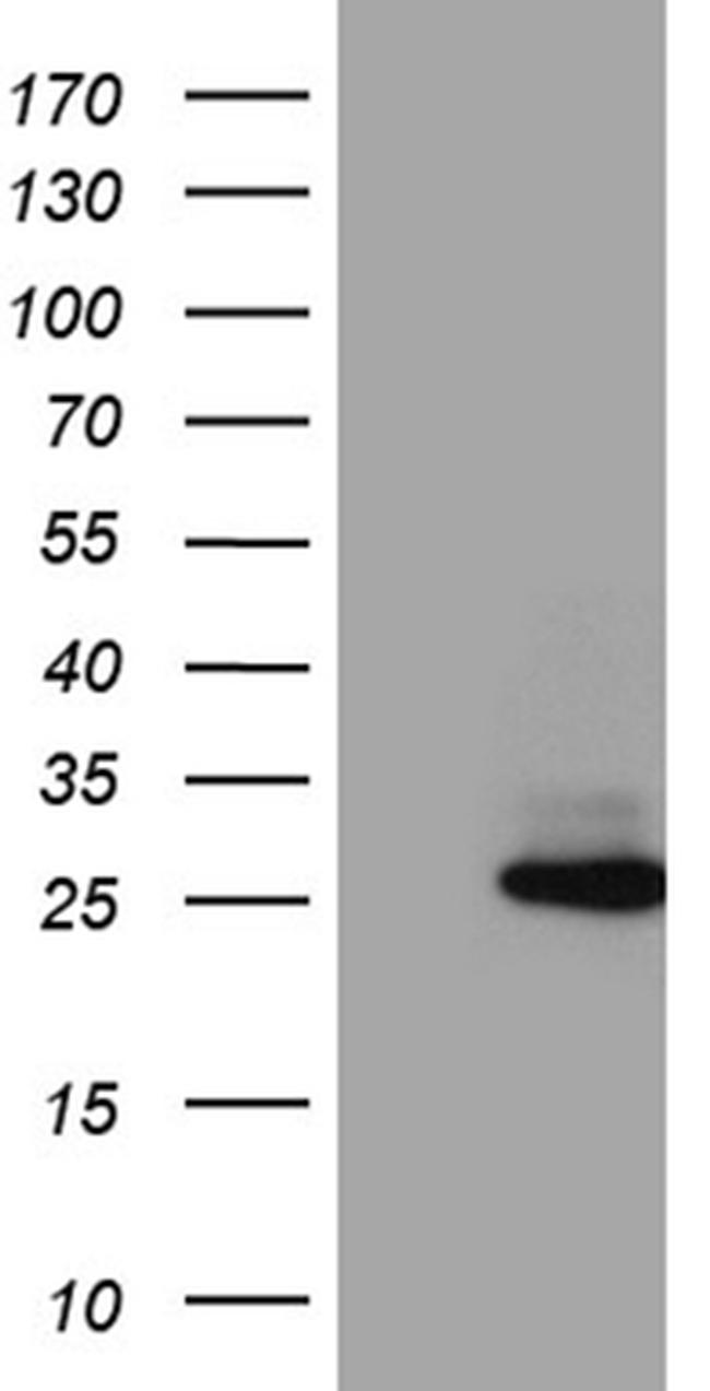 FAM119A Antibody in Western Blot (WB)