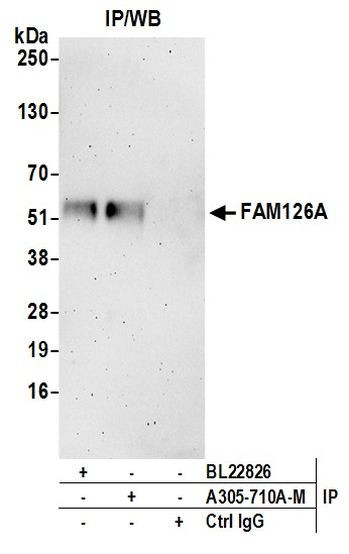 FAM126A Antibody in Immunoprecipitation (IP)