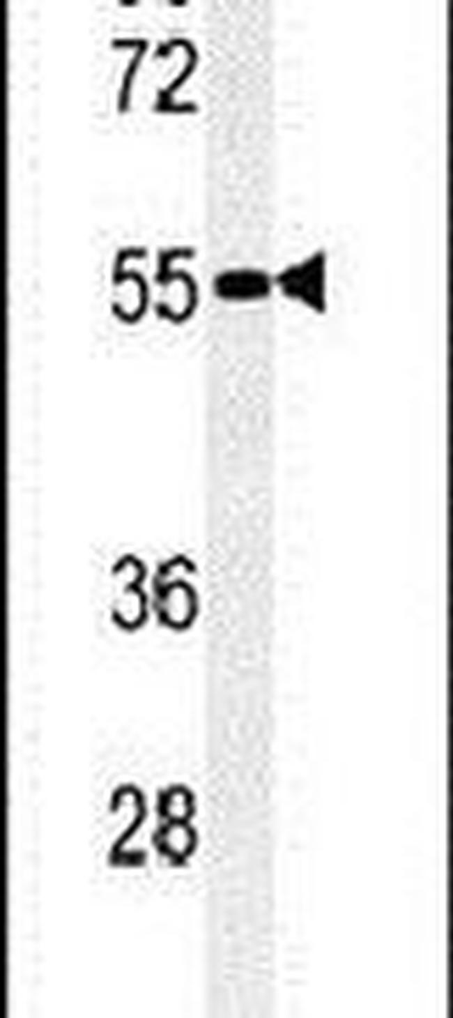 FAM151A Antibody in Western Blot (WB)