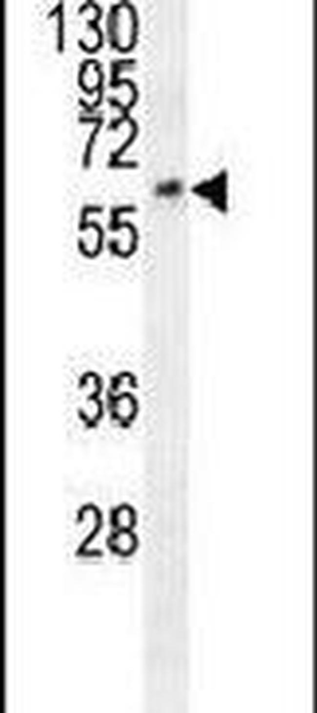 FAM155A Antibody in Western Blot (WB)
