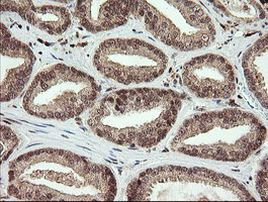FAM164A Antibody in Immunohistochemistry (Paraffin) (IHC (P))