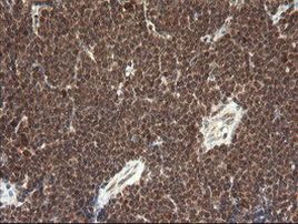 FAM164A Antibody in Immunohistochemistry (Paraffin) (IHC (P))