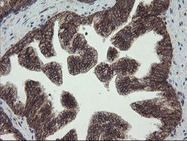 FAM164A Antibody in Immunohistochemistry (Paraffin) (IHC (P))