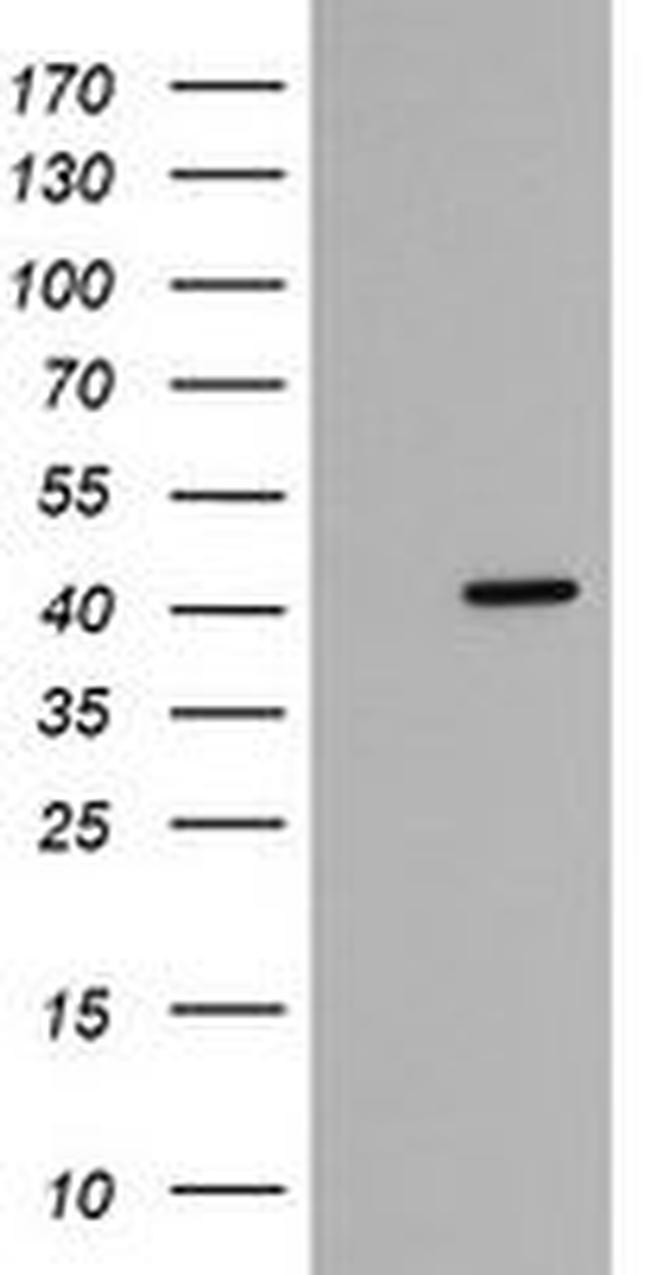 FAM164A Antibody in Western Blot (WB)
