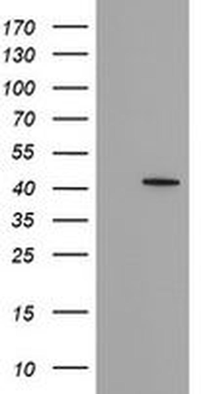 FAM164A Antibody in Western Blot (WB)