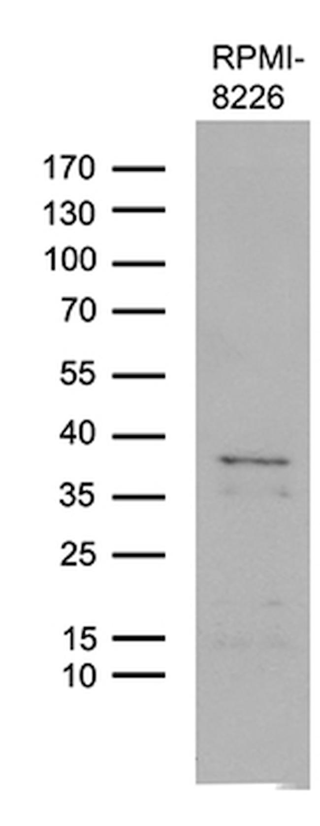 FAM170A Antibody in Western Blot (WB)