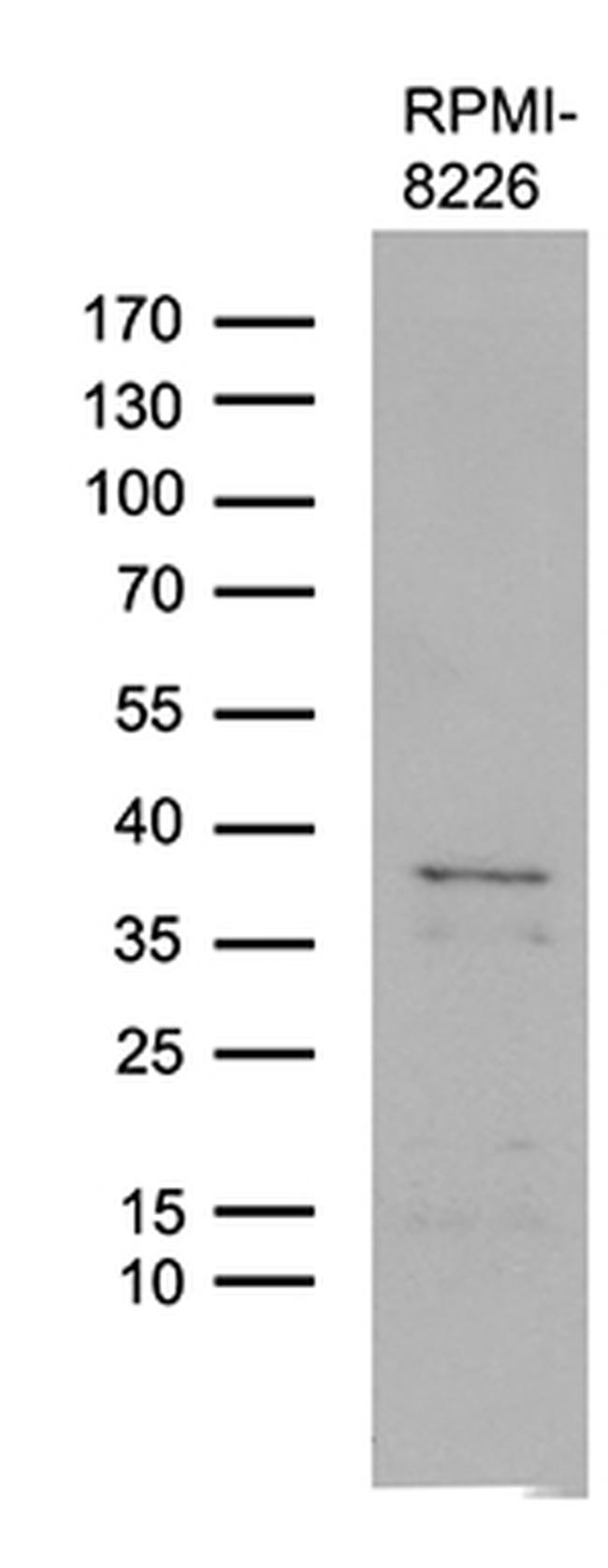 FAM170A Antibody in Western Blot (WB)