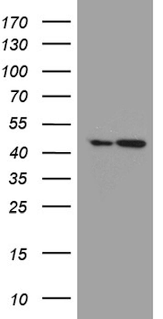 FAM54A Antibody in Western Blot (WB)