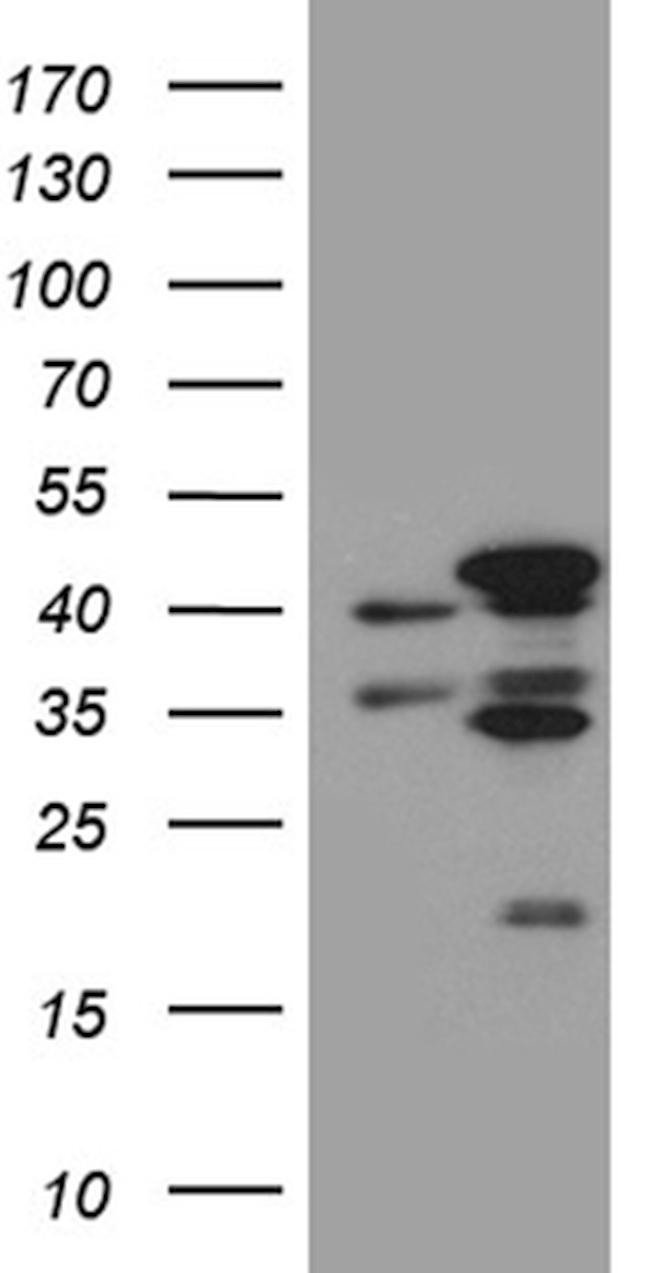 FAM54A Antibody in Western Blot (WB)