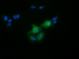 FAM84B Antibody in Immunocytochemistry (ICC/IF)