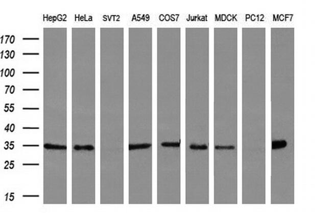 FAM84B Antibody in Western Blot (WB)