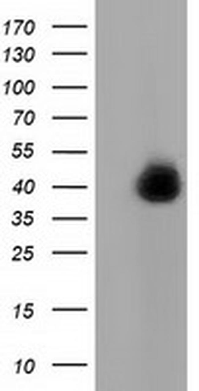 FAM84B Antibody in Western Blot (WB)