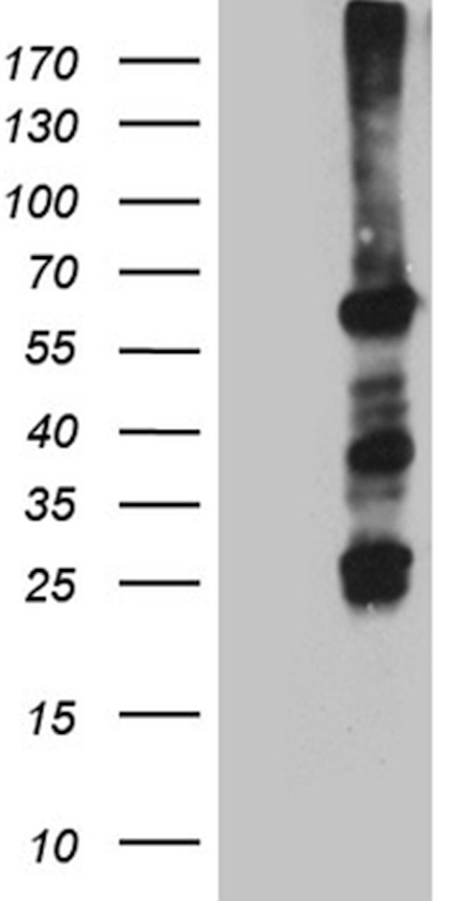 FANCC Antibody in Western Blot (WB)
