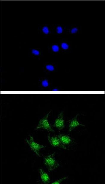FANCC Antibody in Immunocytochemistry (ICC/IF)