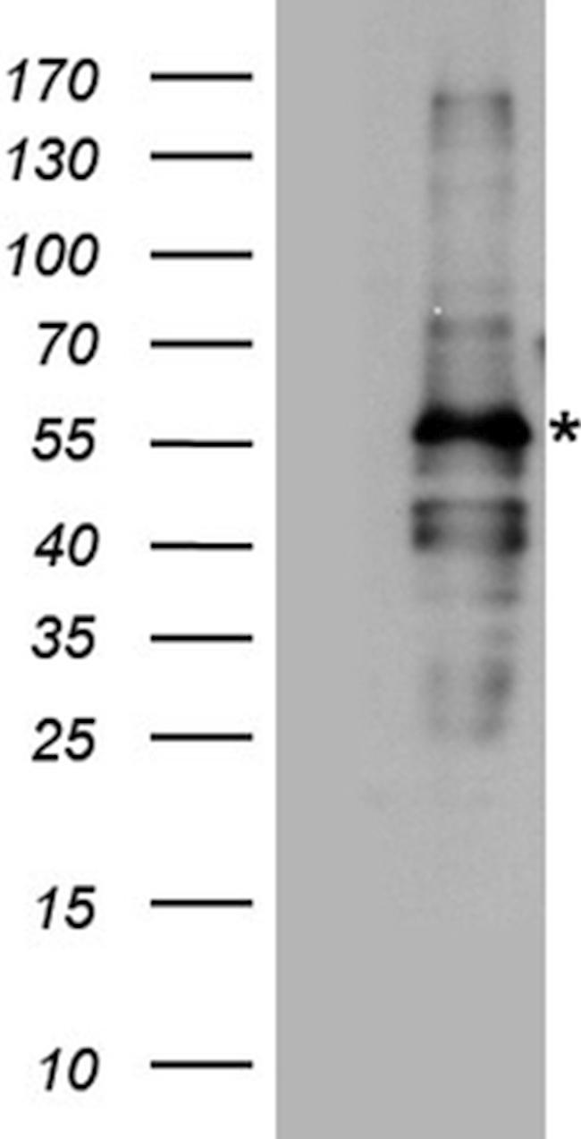 FANCE Antibody in Western Blot (WB)
