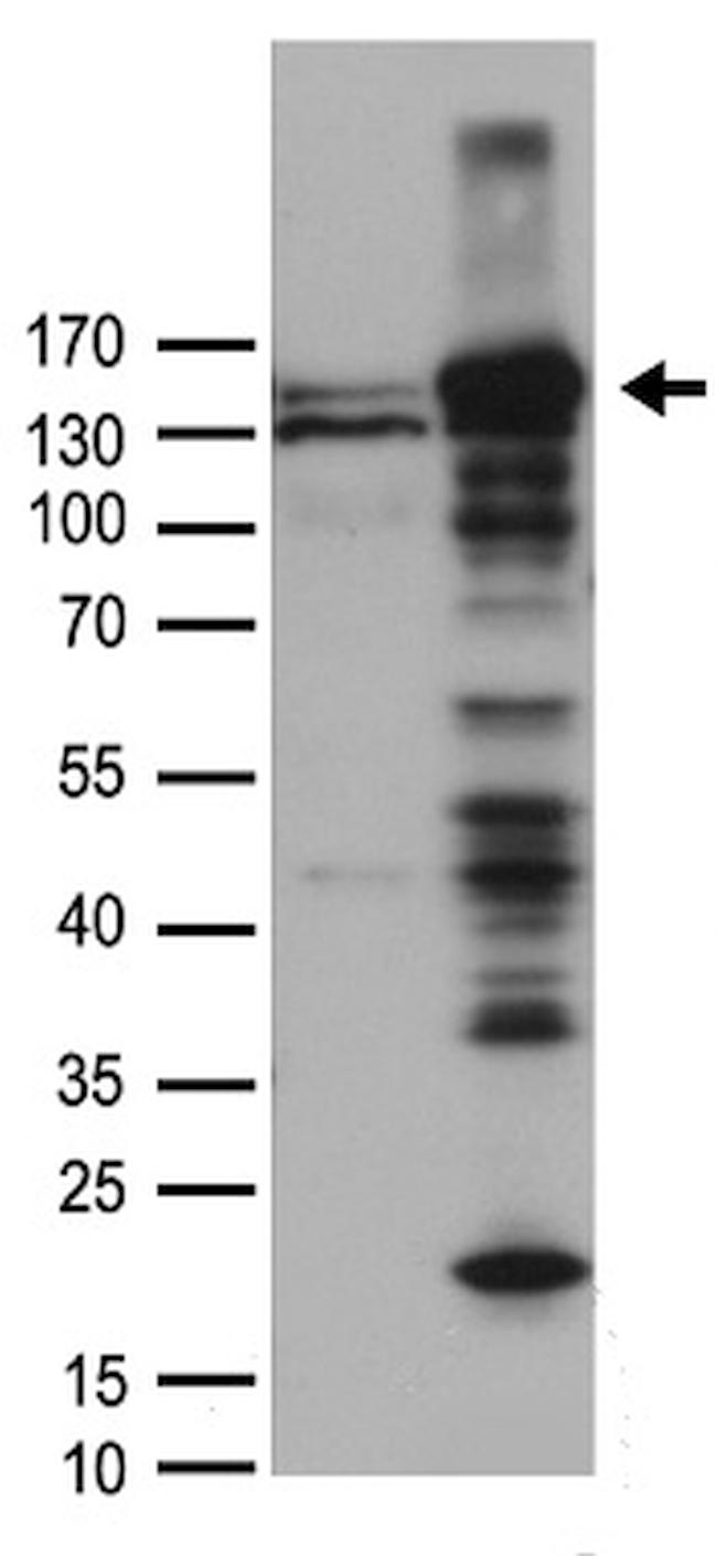 FANCI Antibody in Western Blot (WB)
