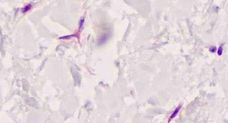 FAP Antibody in Immunohistochemistry (Paraffin) (IHC (P))