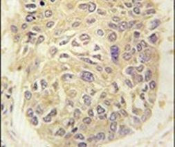 FARSA Antibody in Immunohistochemistry (IHC)