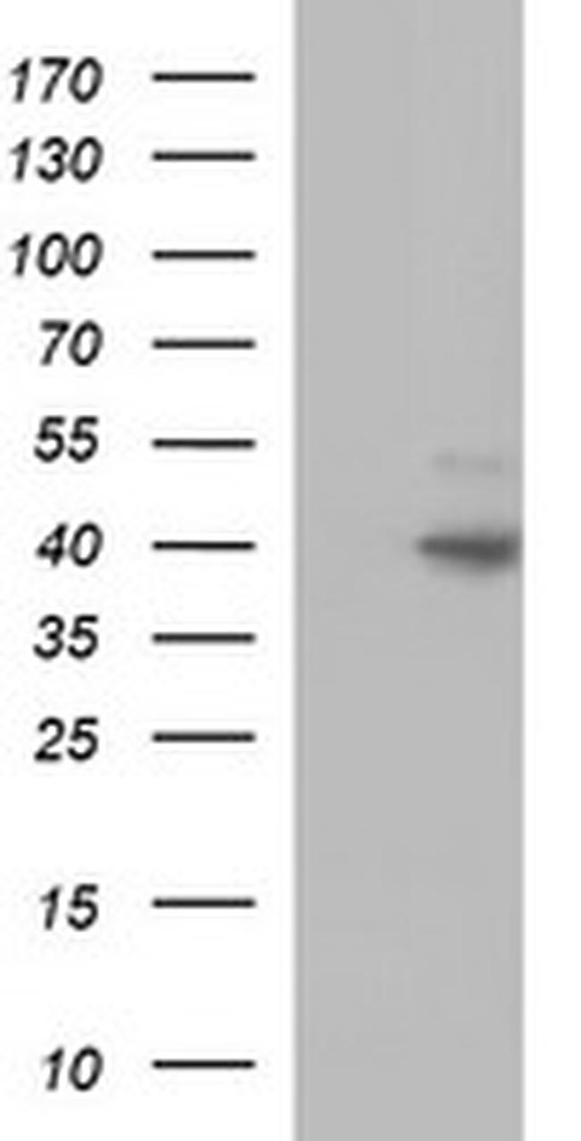 FAS Antibody in Western Blot (WB)