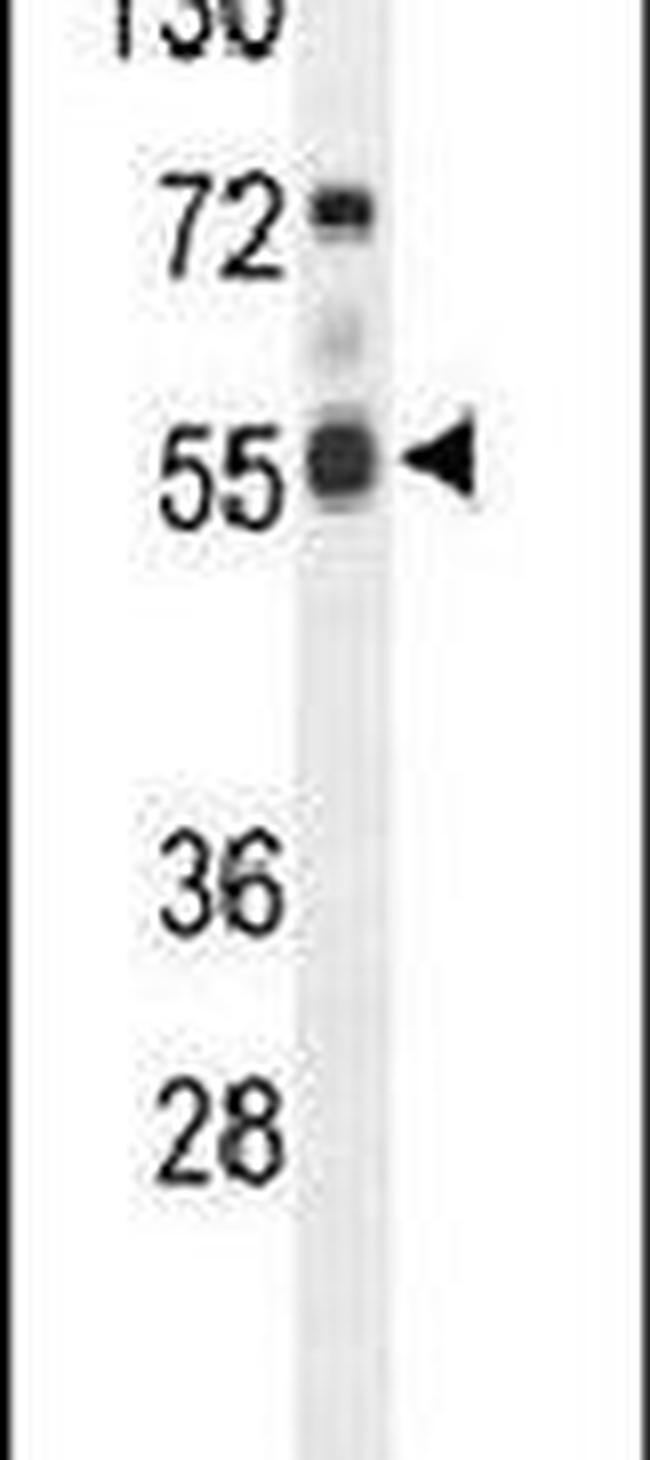 FASTK Antibody in Western Blot (WB)