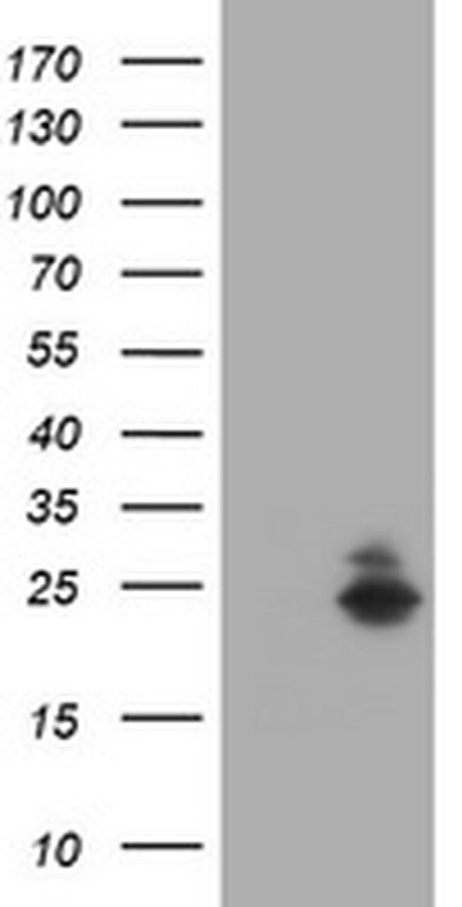 FATE1 Antibody in Western Blot (WB)