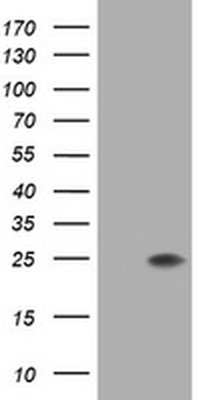 FATE1 Antibody in Western Blot (WB)