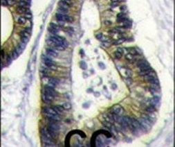 FAU Antibody in Immunohistochemistry (IHC)