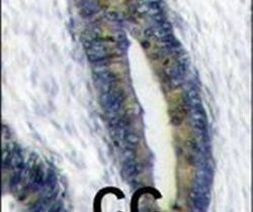 FAU Antibody in Immunohistochemistry (IHC)