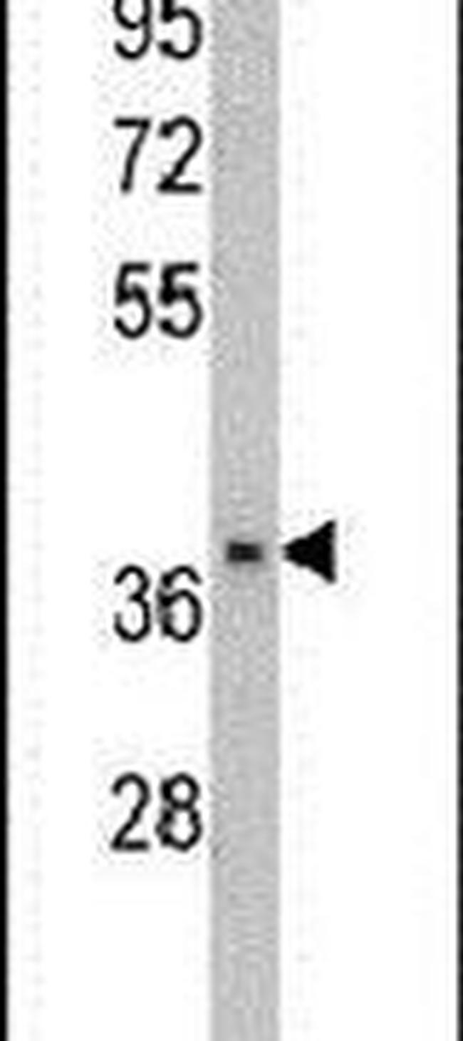 FBP2 Antibody in Western Blot (WB)