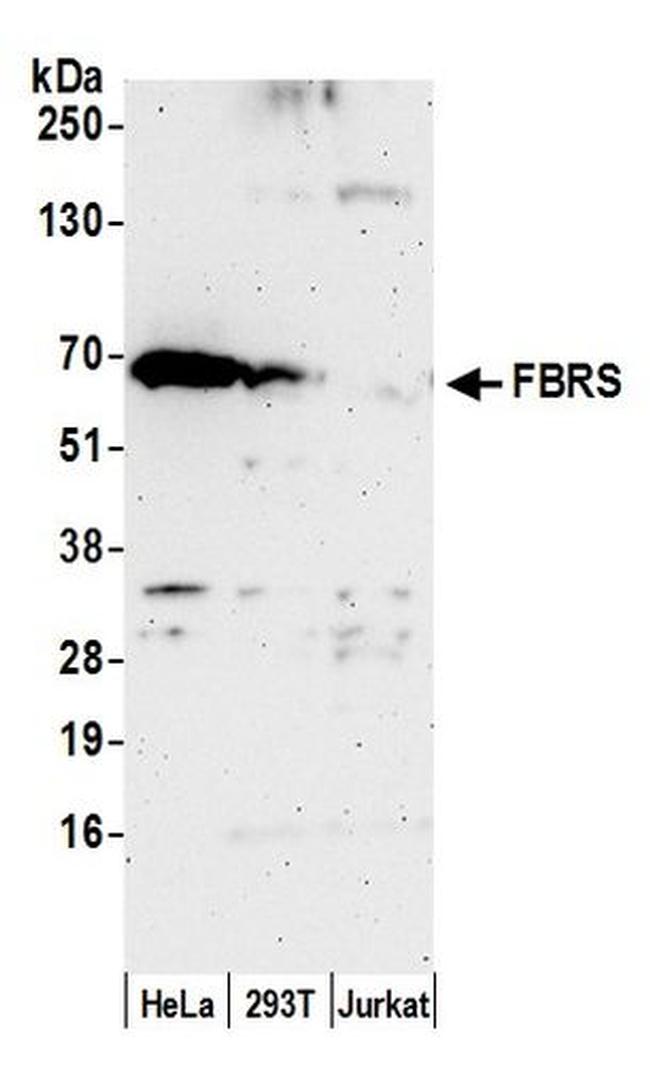 FBRS Antibody in Western Blot (WB)