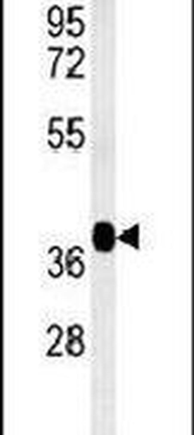 FBXL14 Antibody in Western Blot (WB)