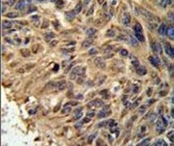FBXL2 Antibody in Immunohistochemistry (IHC)