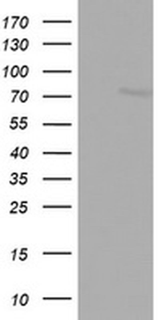 FBXO11 Antibody in Western Blot (WB)