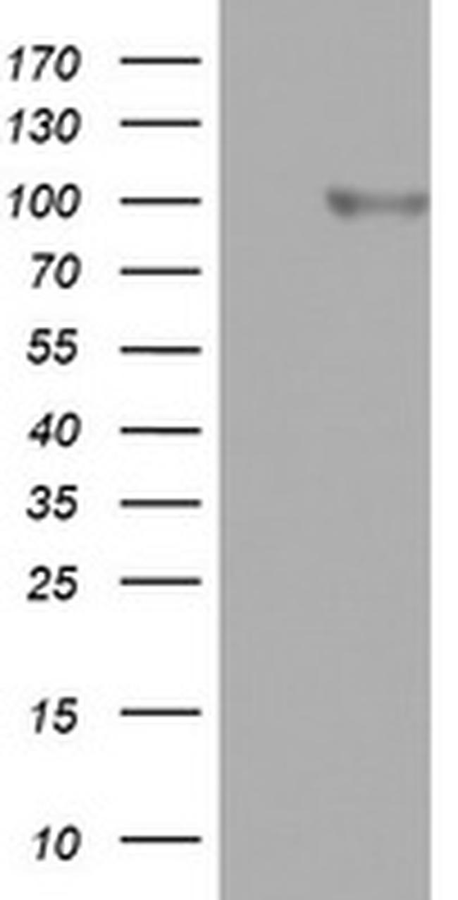 FBXO11 Antibody in Western Blot (WB)