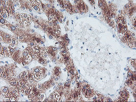 FBXO21 Antibody in Immunohistochemistry (Paraffin) (IHC (P))