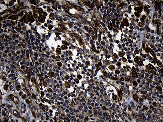 FBXO25 Antibody in Immunohistochemistry (Paraffin) (IHC (P))