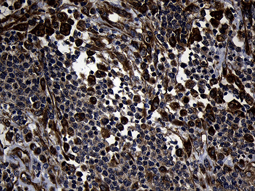 FBXO25 Antibody in Immunohistochemistry (Paraffin) (IHC (P))