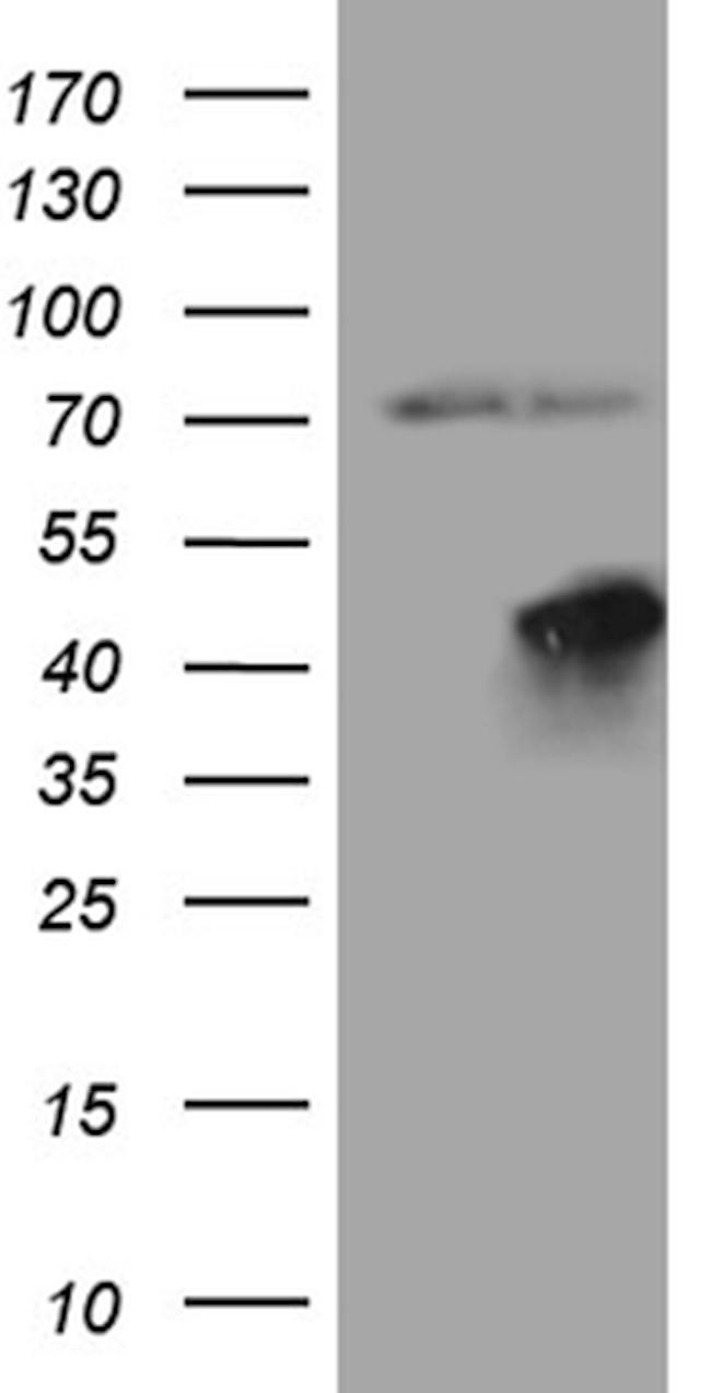 FBXO25 Antibody in Western Blot (WB)