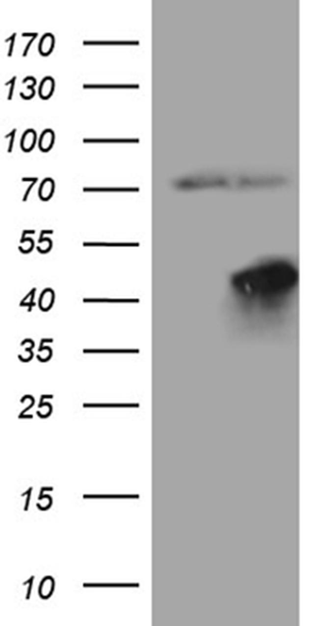 FBXO25 Antibody in Western Blot (WB)