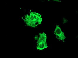 FBXO31 Antibody in Immunocytochemistry (ICC/IF)