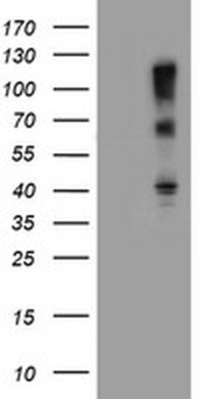 FBXO31 Antibody in Western Blot (WB)