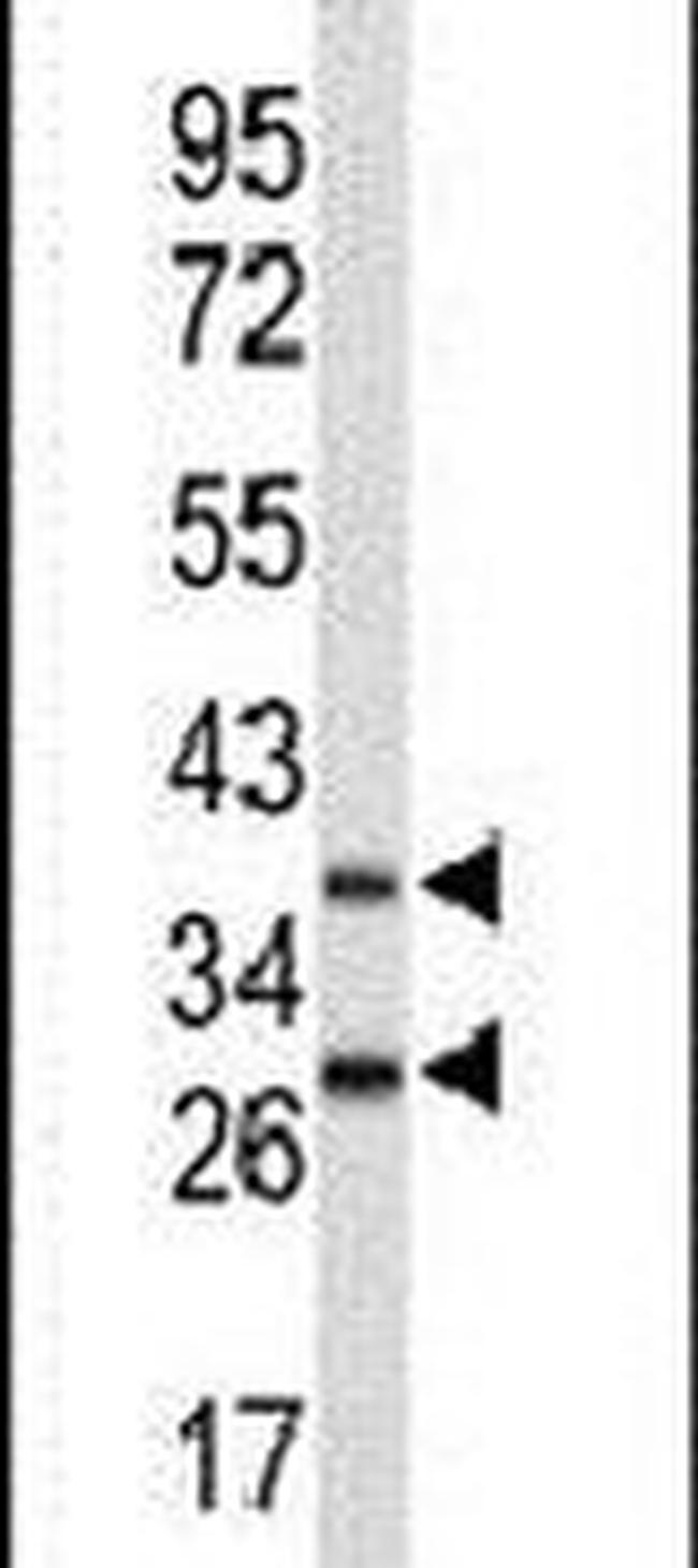 FBXO4 Antibody in Western Blot (WB)